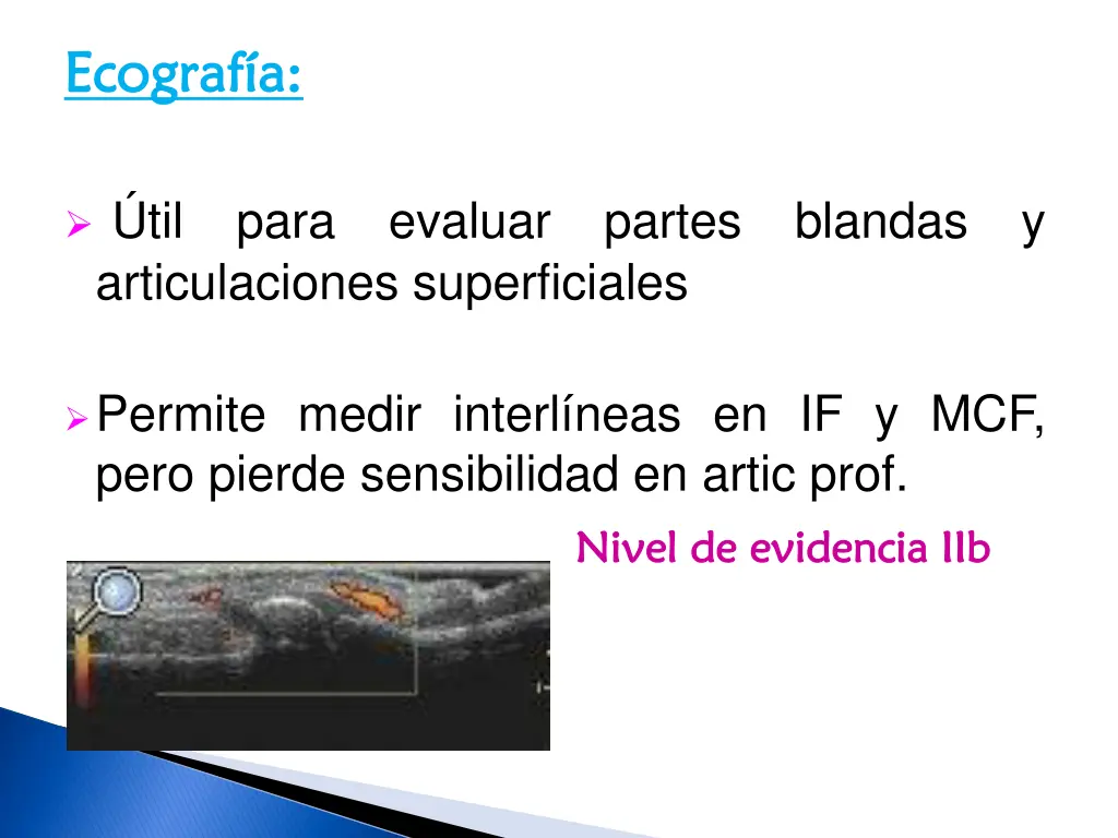 ecograf a ecograf a