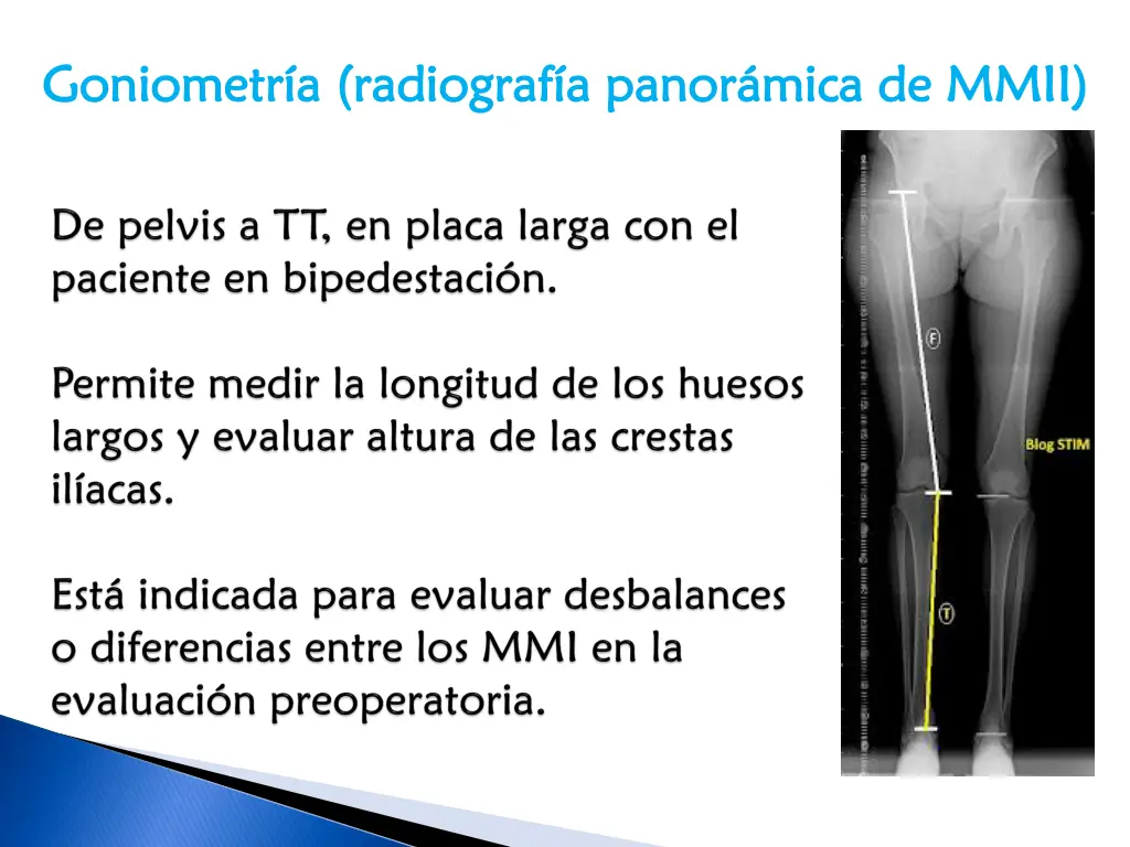 goniometr a radiograf a panor mica de mmii