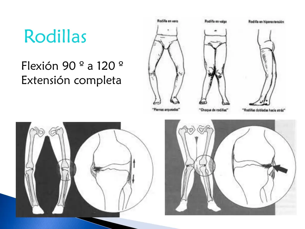 rodillas