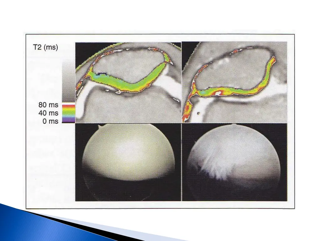 slide25