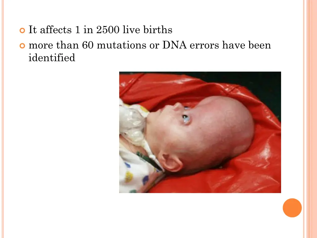 it affects 1 in 2500 live births more than
