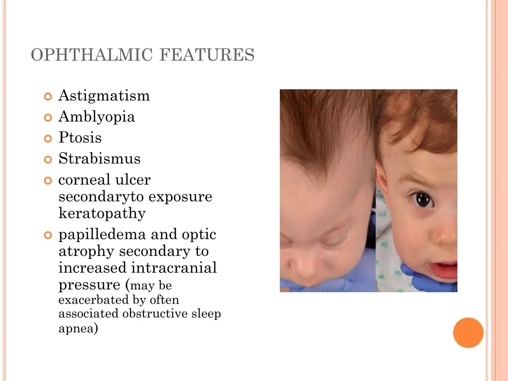 ophthalmic features
