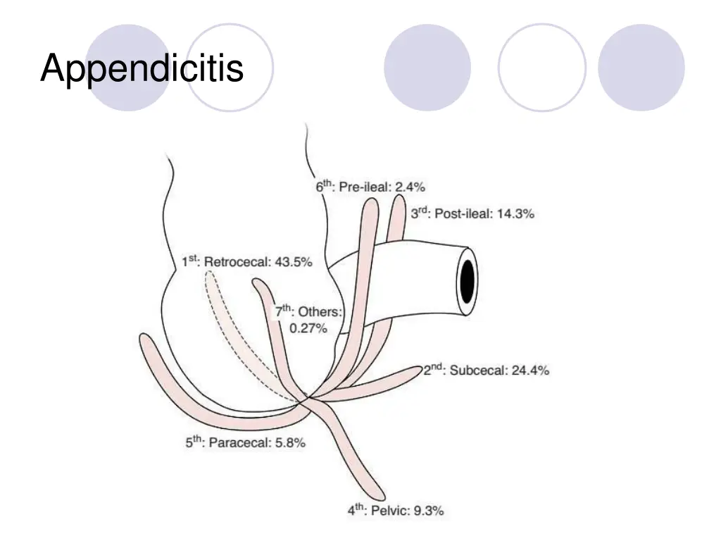 appendicitis 1