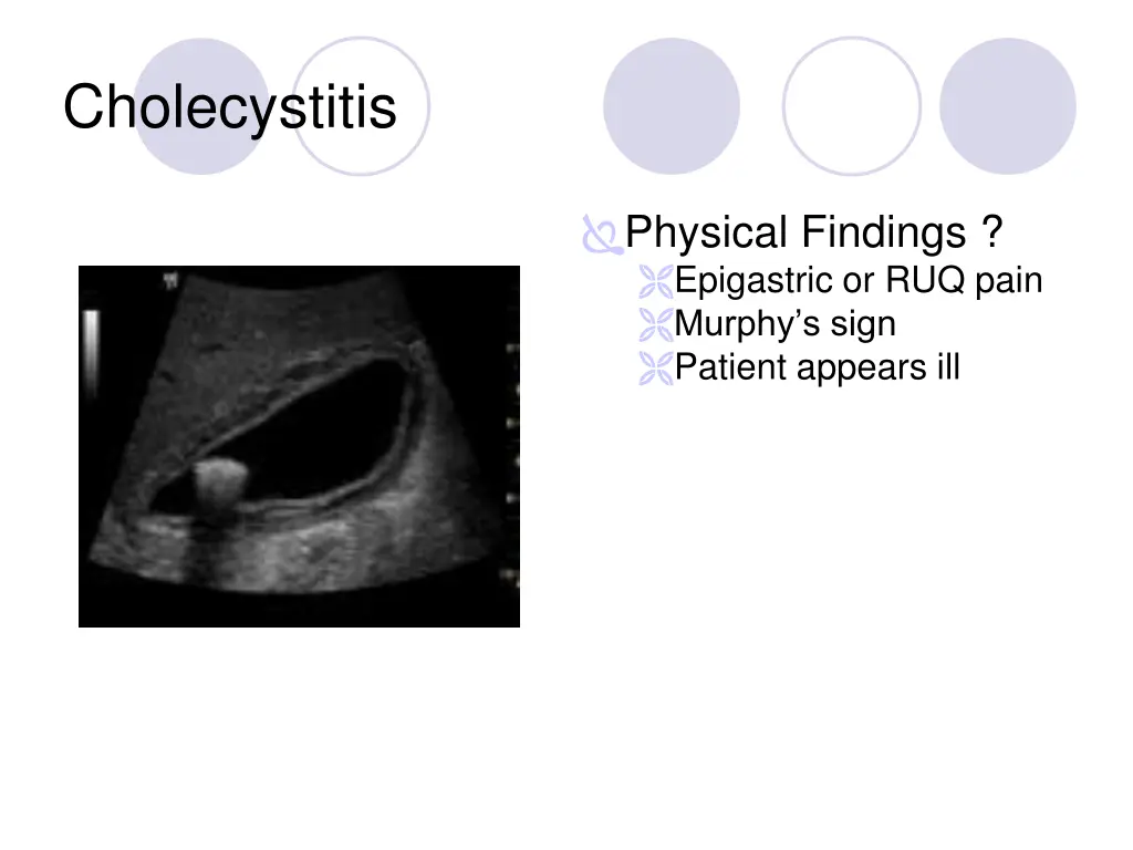 cholecystitis 1