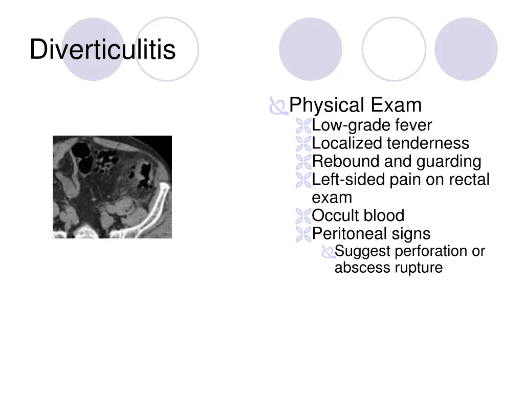 diverticulitis 1