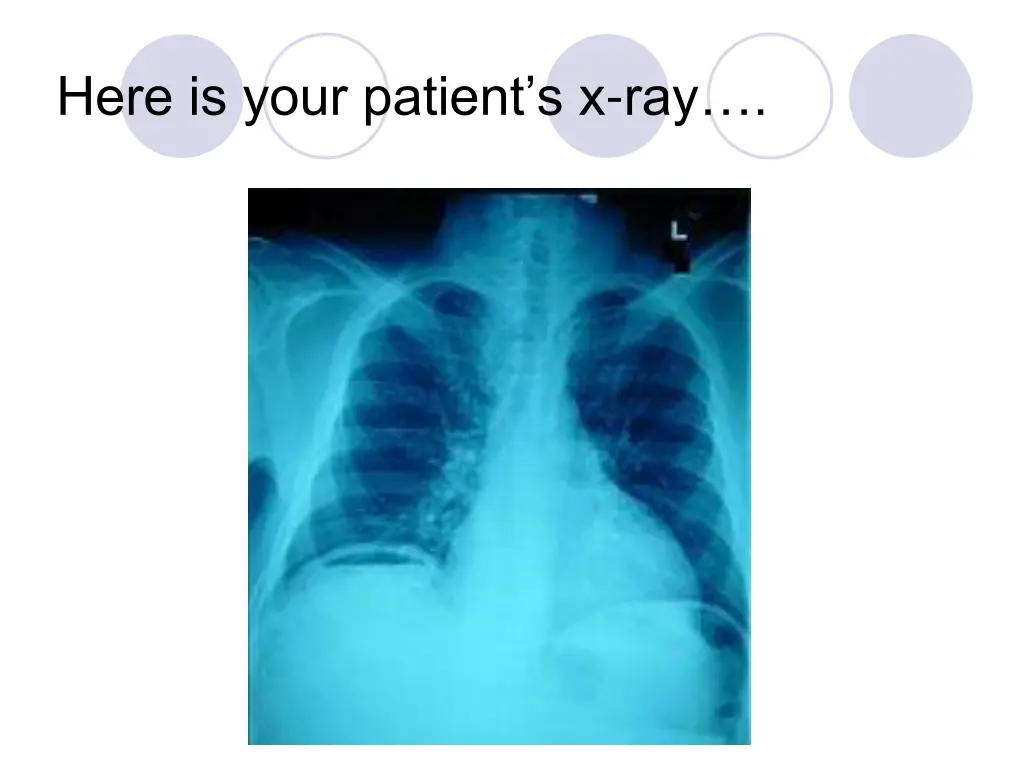 here is your patient s x ray