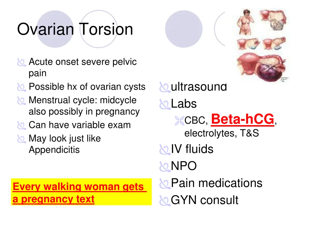 ovarian torsion
