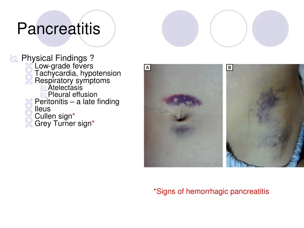 pancreatitis 1