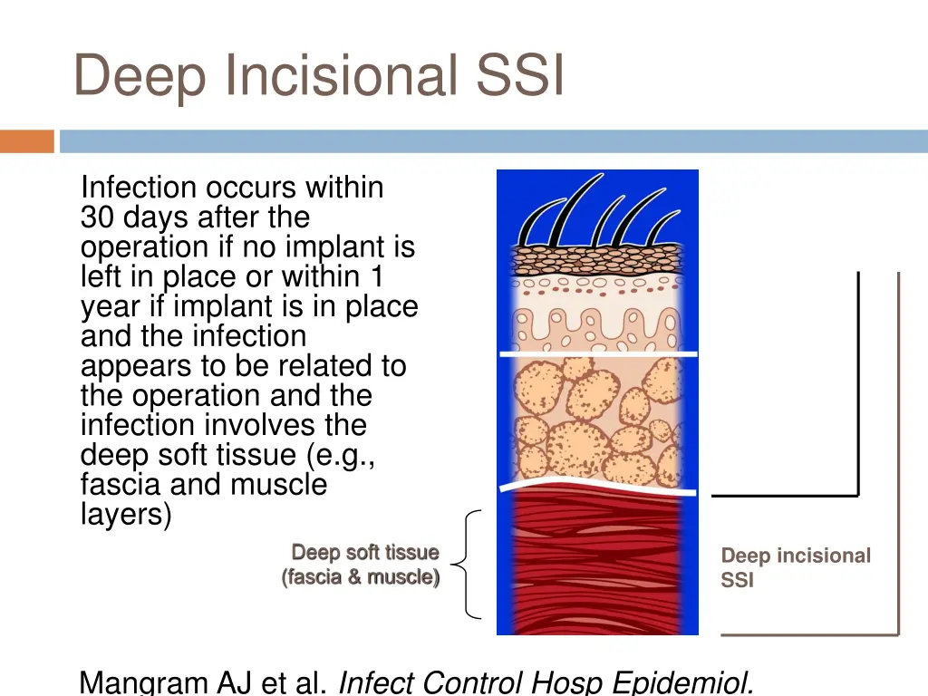 deep incisional ssi