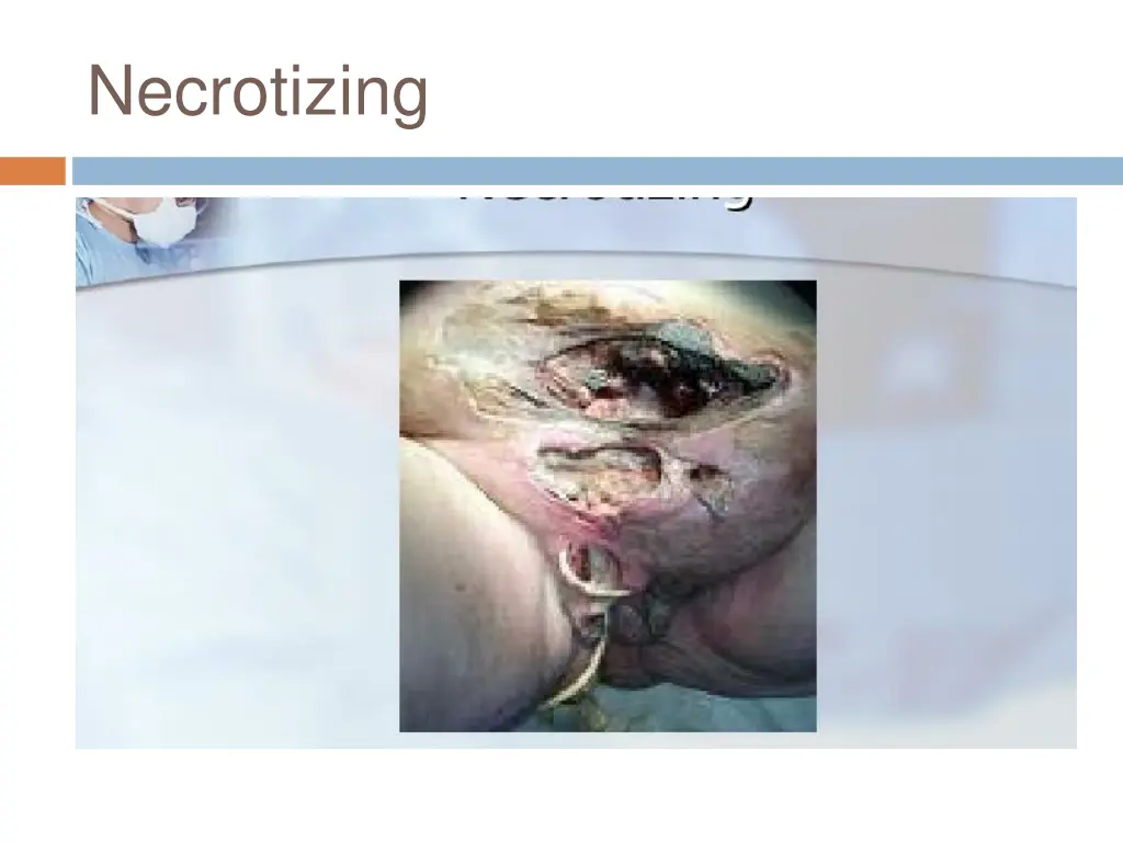 necrotizing