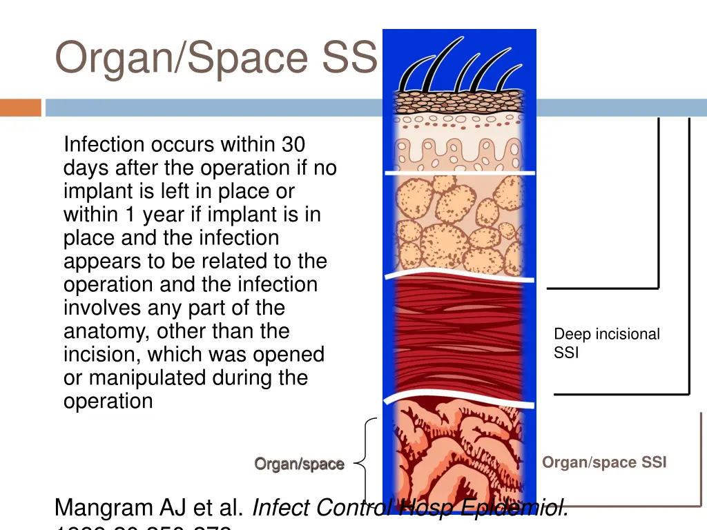 organ space ssi