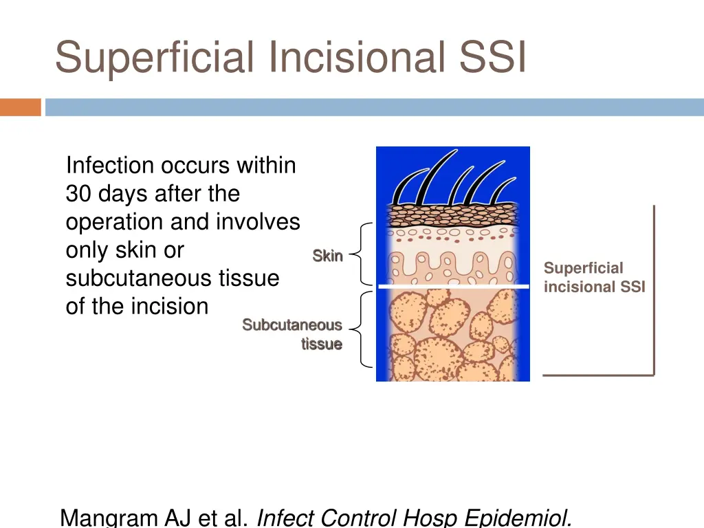 superficial incisional ssi