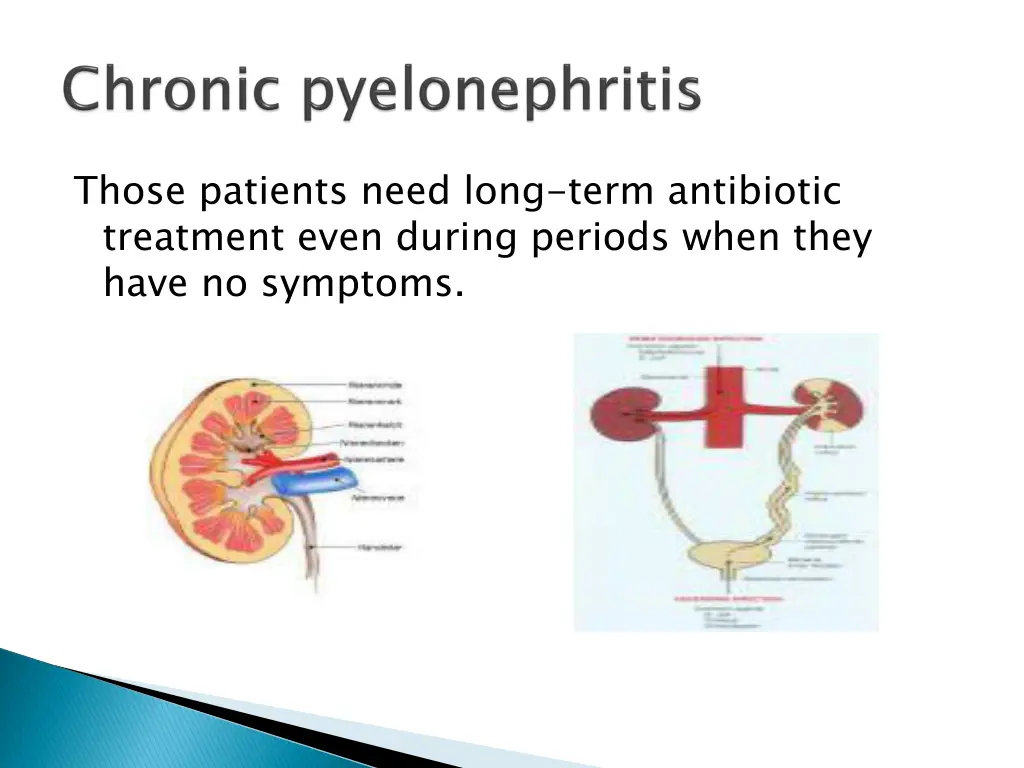 those patients need long term antibiotic