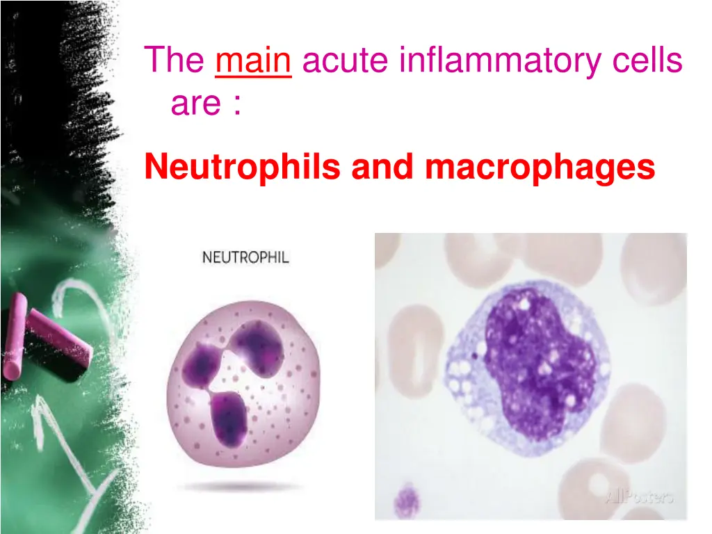 the main acute inflammatory cells are