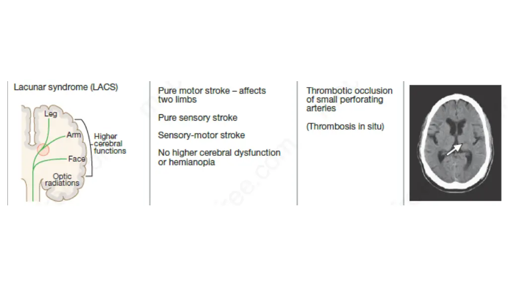 slide10