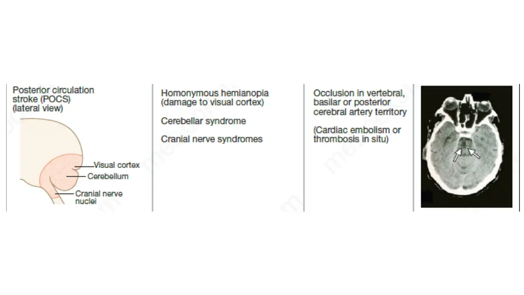 slide11