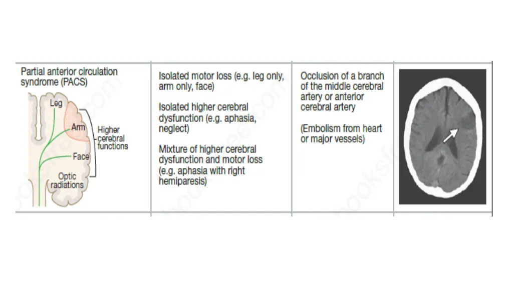 slide9