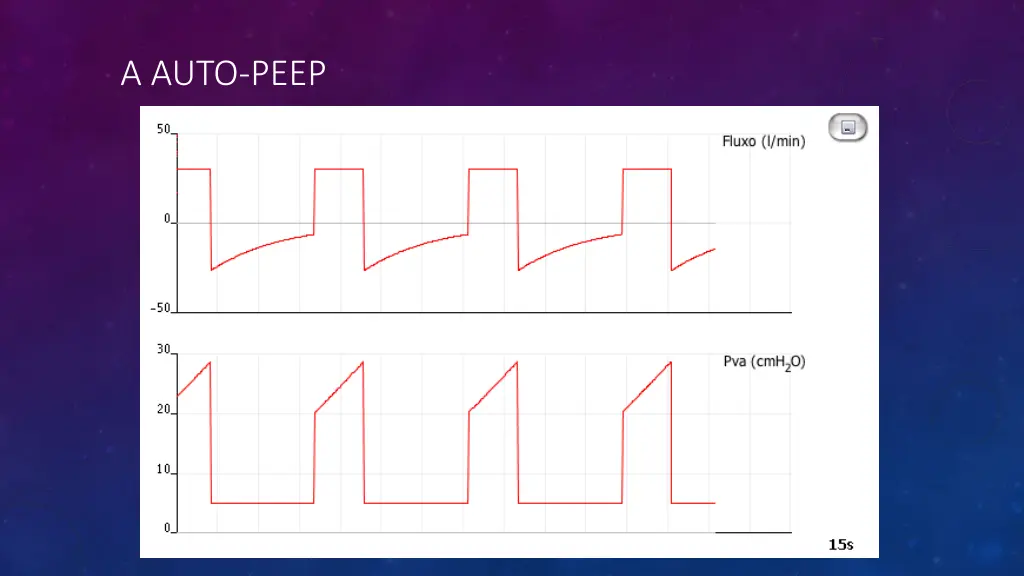 a auto peep