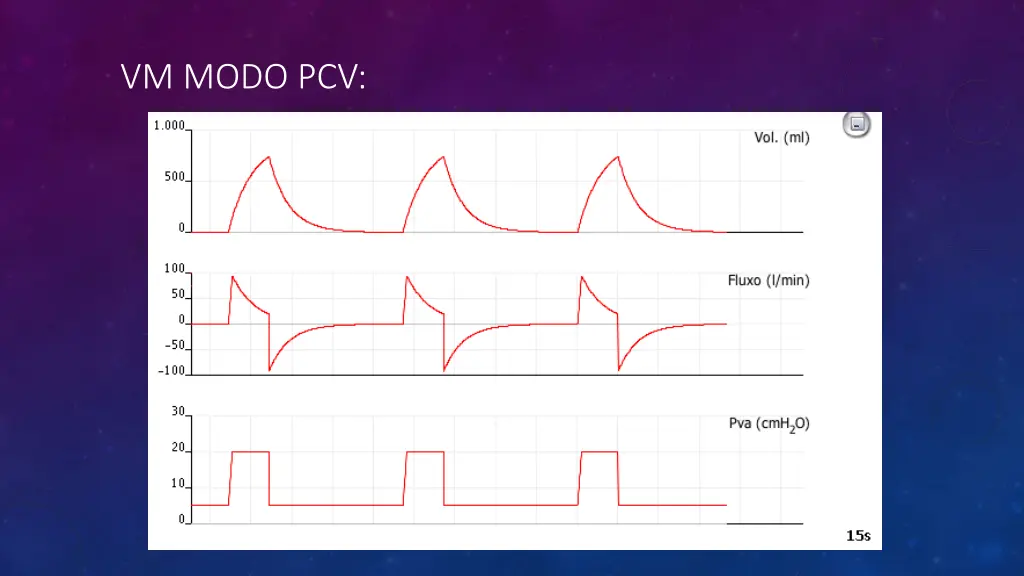 vm modo pcv