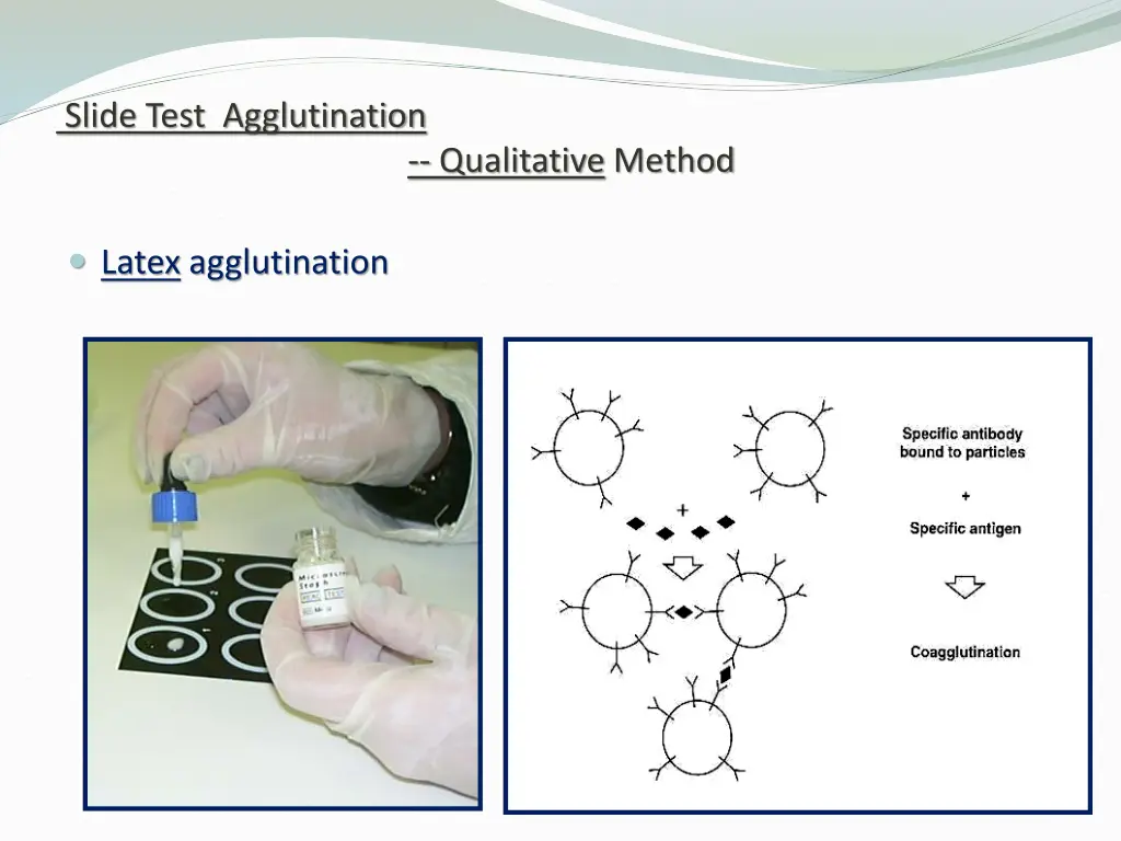 slide test agglutination