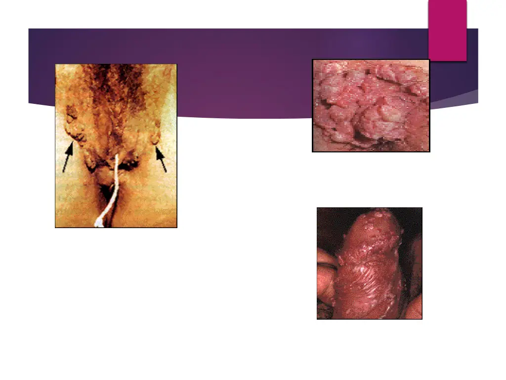 slide34