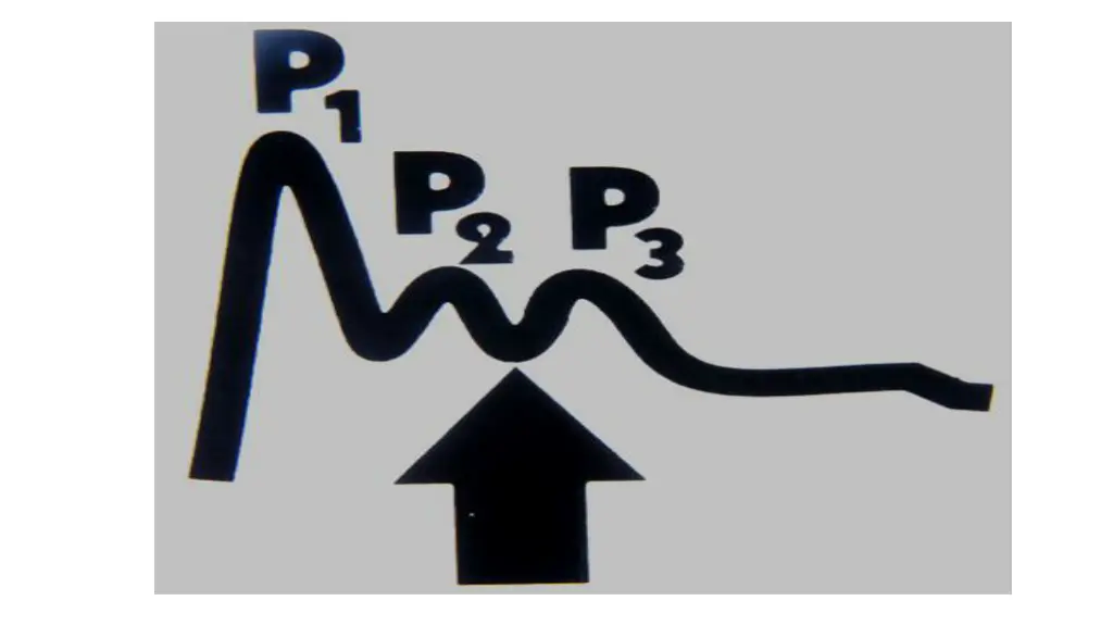 slide6