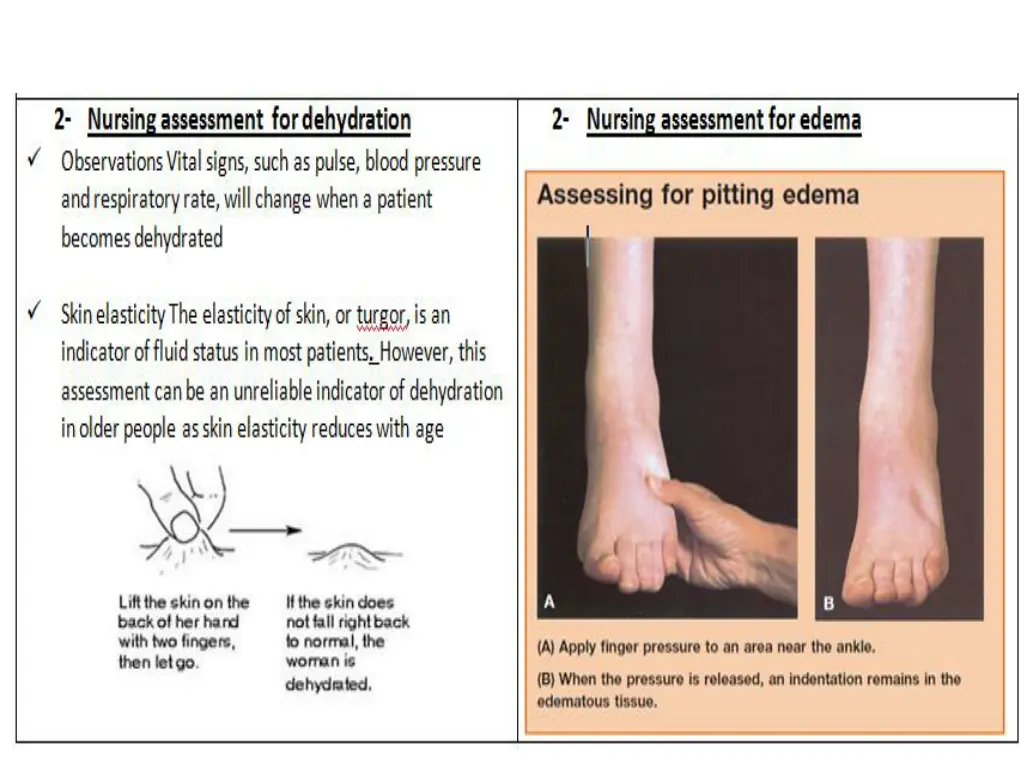 slide9