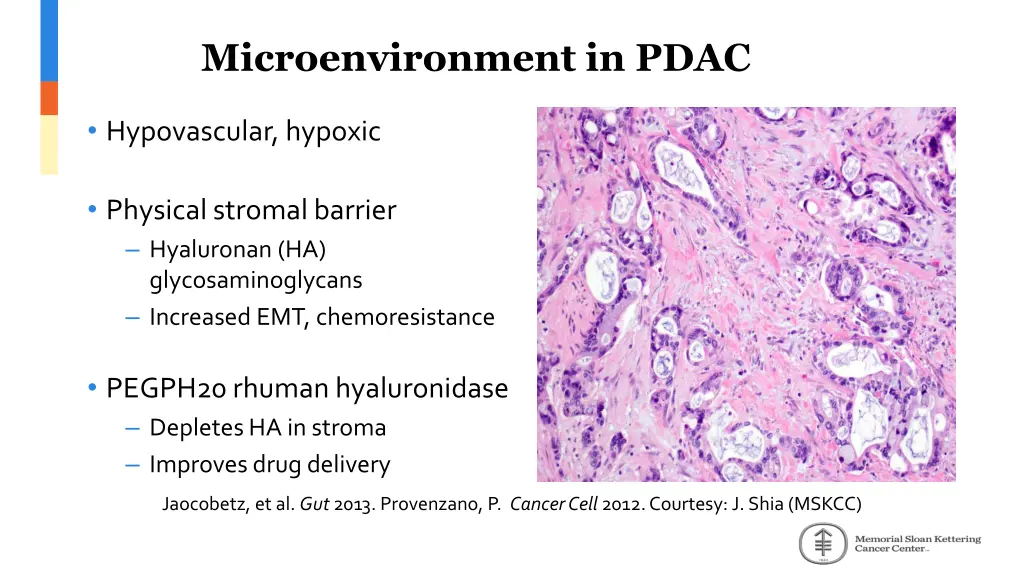 microenvironment in pdac