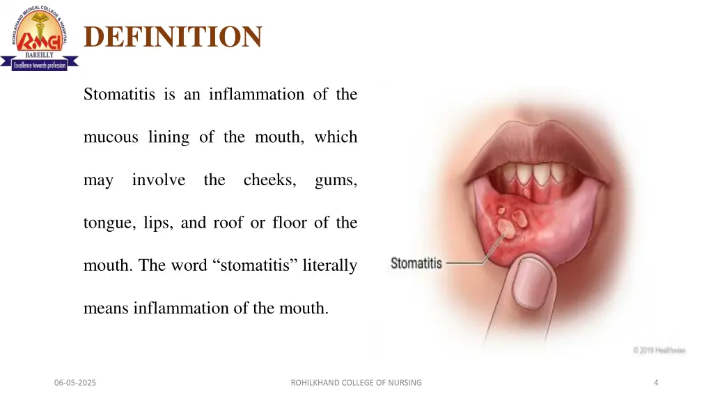 definition