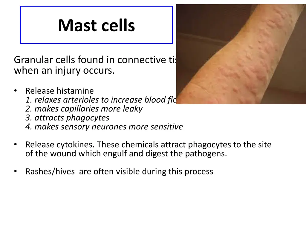 mast cells