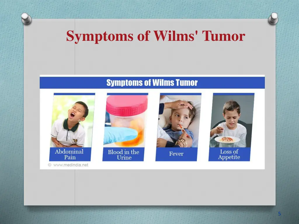 symptoms of wilms tumor