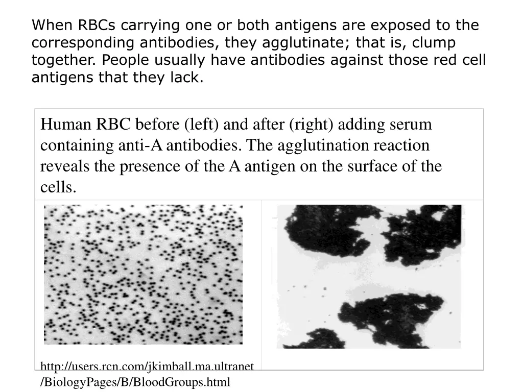 when rbcs carrying one or both antigens