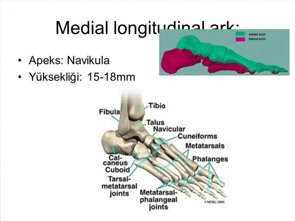 slide28