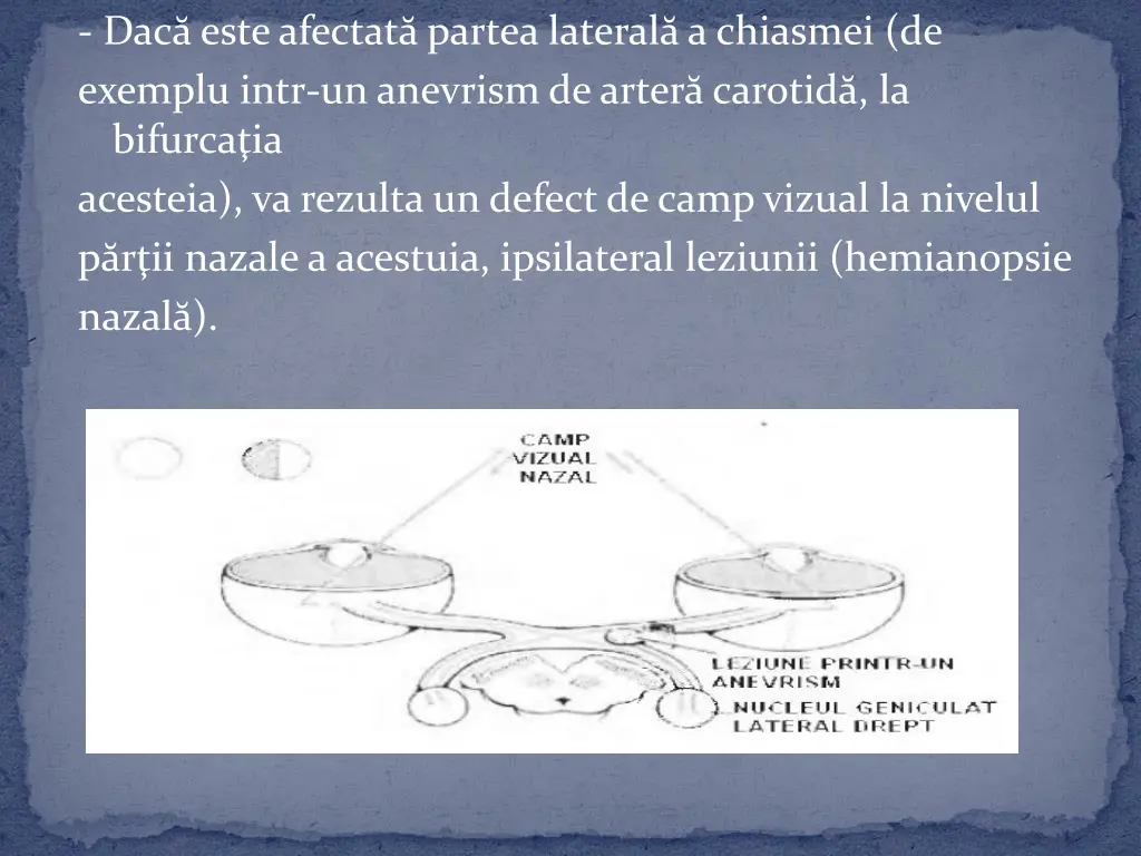 dac este afectat partea lateral a chiasmei