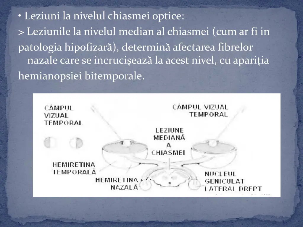 leziuni la nivelul chiasmei optice leziunile