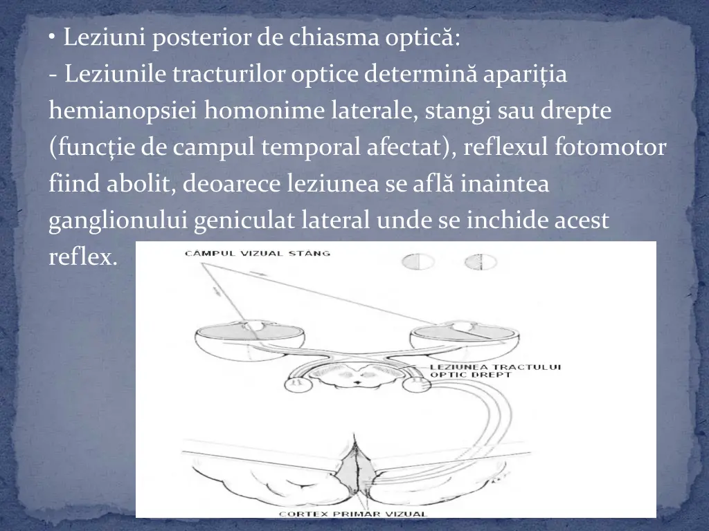 leziuni posterior de chiasma optic leziunile