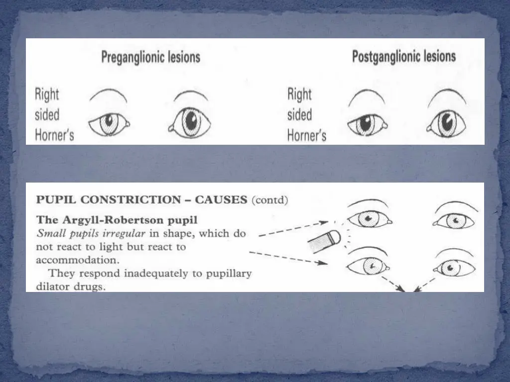 slide14