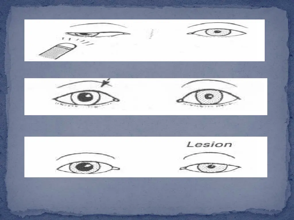 slide15