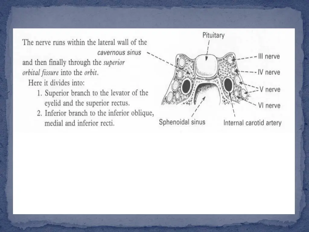slide29