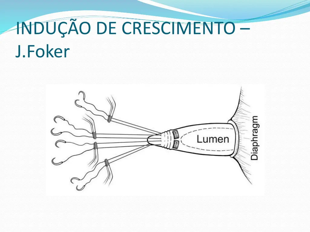 indu o de crescimento j foker 1