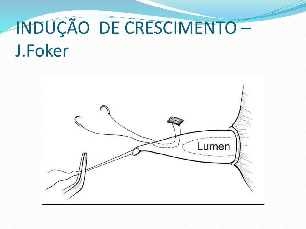 indu o de crescimento j foker