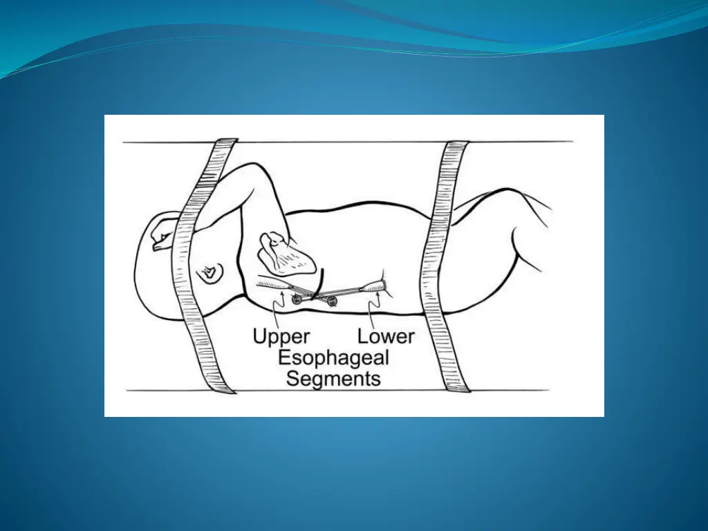 slide35