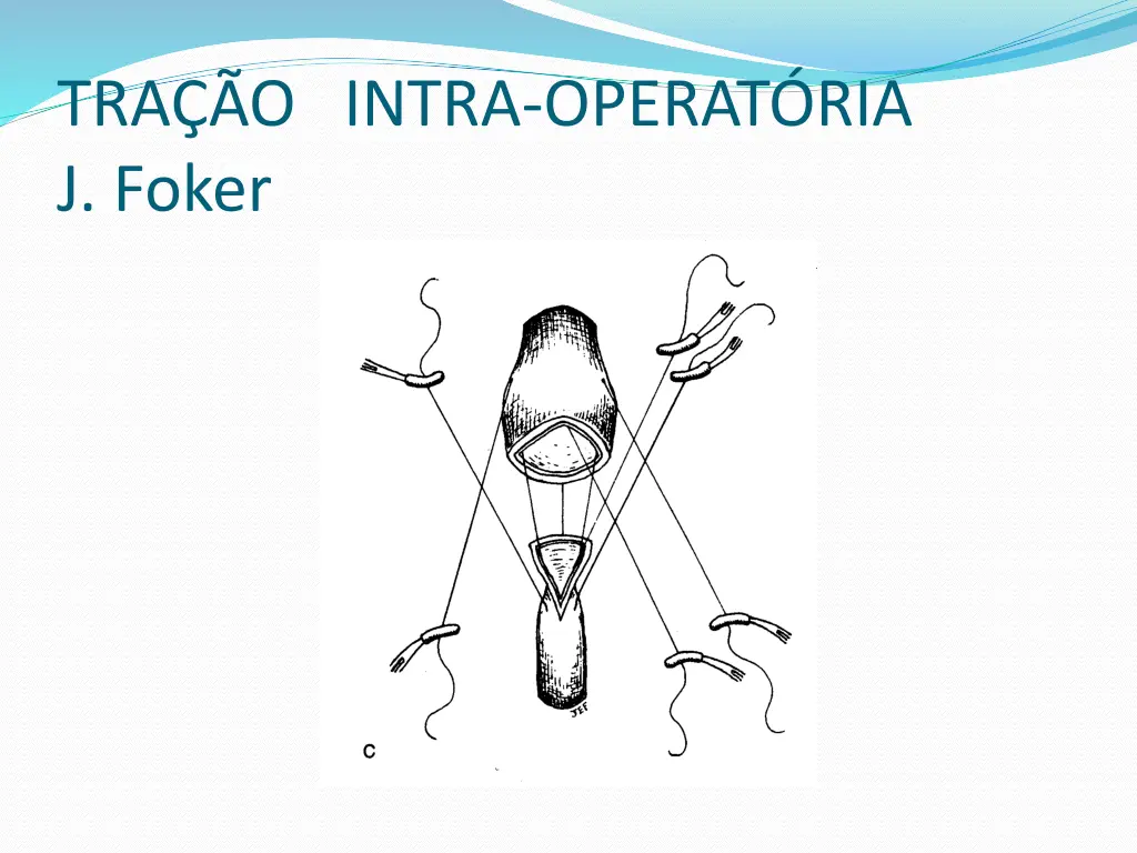tra o intra operat ria j foker