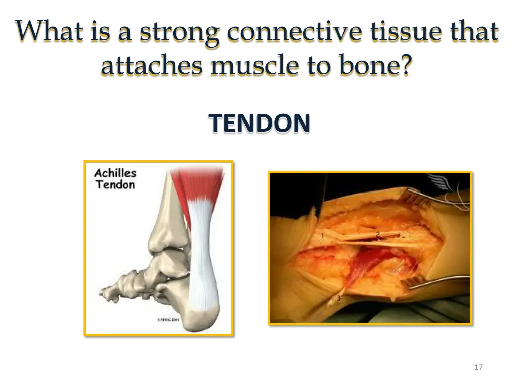 what is a strong connective tissue that attaches