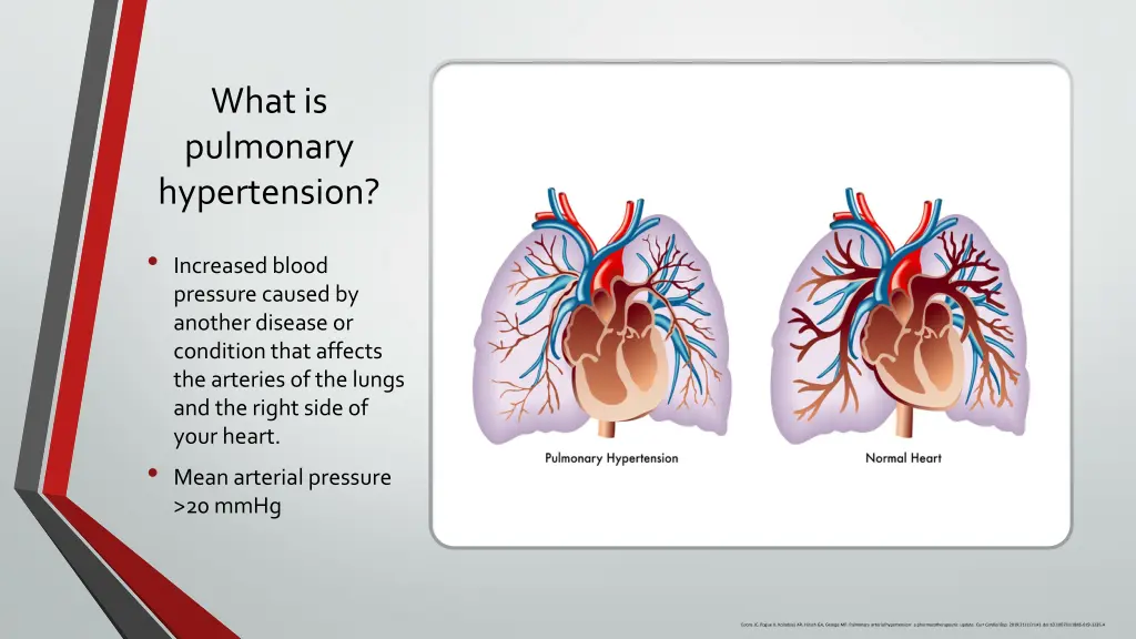 what is pulmonary hypertension