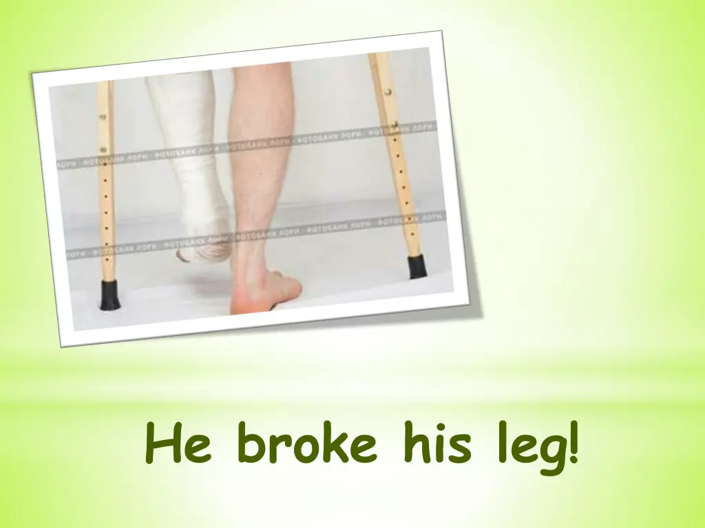 he broke his leg