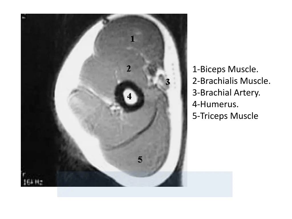 1 biceps muscle 2 brachialis muscle 3 brachial