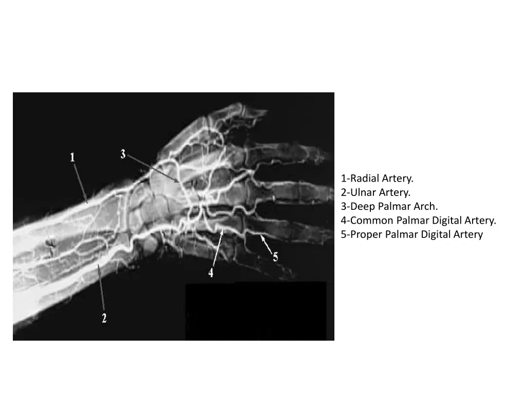 1 radial artery 2 ulnar artery 3 deep palmar arch