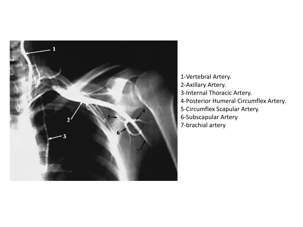1 vertebral artery 2 axillary artery 3 internal