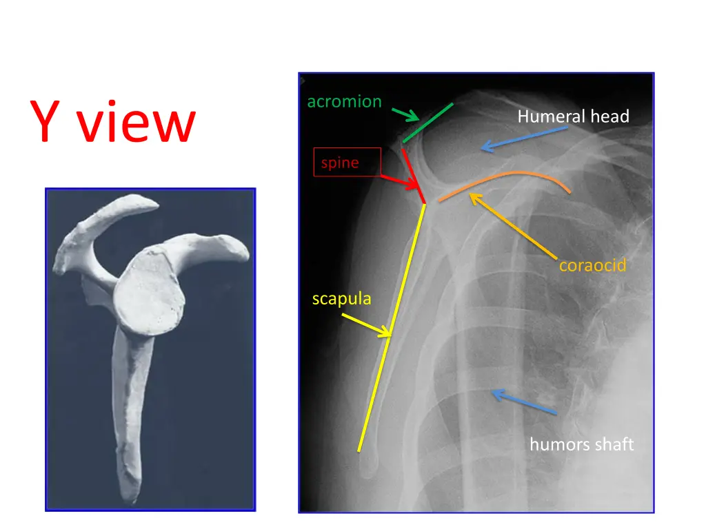 acromion 1